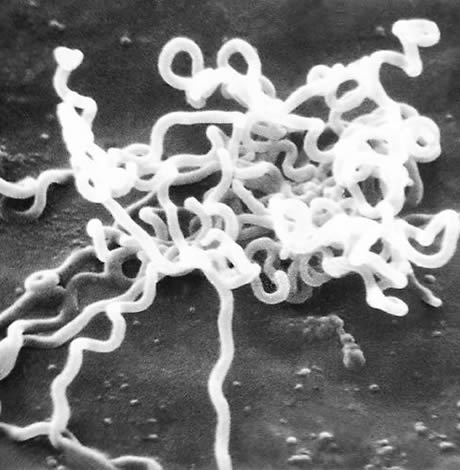 Treponema pallidum, syphilis, gay news, Washington Blade